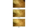 Silk'n Antiaging-Gerät FaceTite Mini
