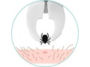 Ticksafe Erste-Hilfe-Set Rotierender Zeckengreifer Tier
