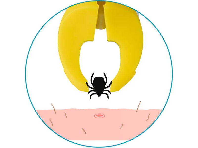 Ticksafe Erste-Hilfe-Set Rotierender Zeckengreifer Mensch