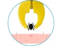 Ticksafe Erste-Hilfe-Set Rotierender Zeckengreifer Mensch